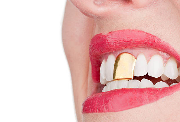 How To Start Up A Gold Teeth Business