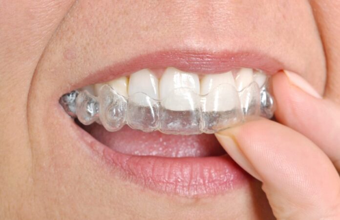 Invisalign