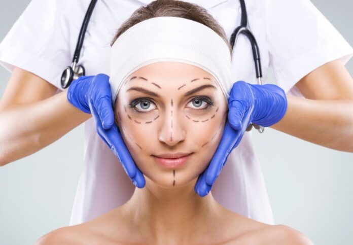 facelift surgery