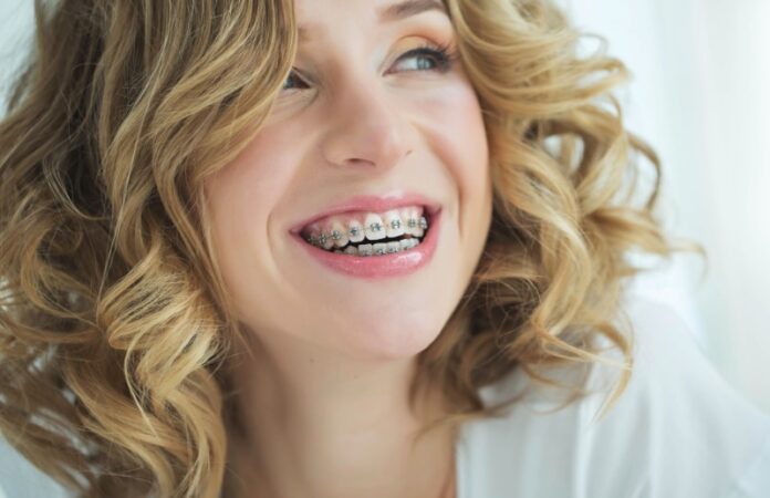 teeth straightening options